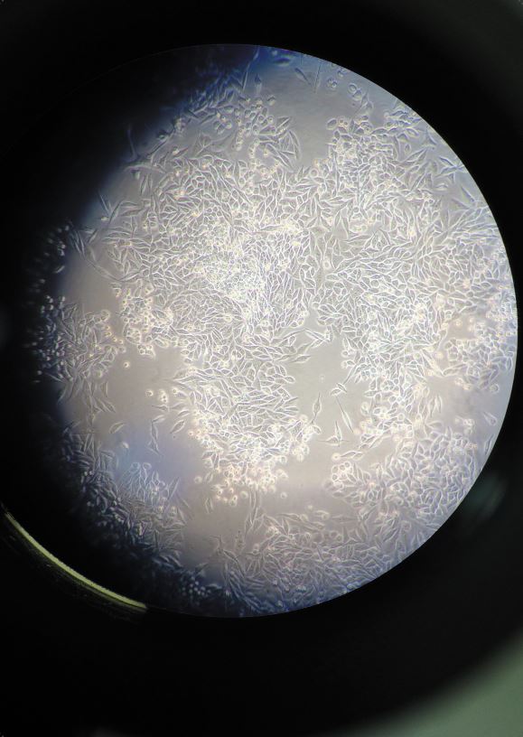 Moon cells Matthew Lee